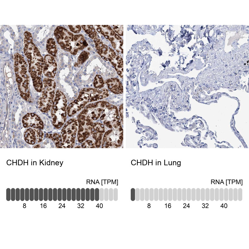 Immunohistochemistry analysis in human kidney and lung tissues using Anti-CHDH antibody. Corresponding CHDH RNA-seq data are presented for the same tissues.