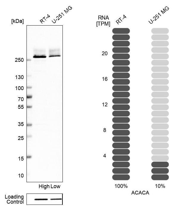 Western blot analysis in human cell line RT-4 and human cell line U-251 MG.