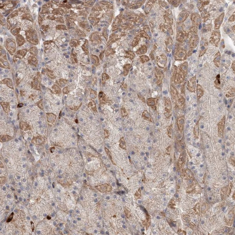 Immunohistochemical staining of human stomach shows moderate ctyolasmic positivity in glandular cells.