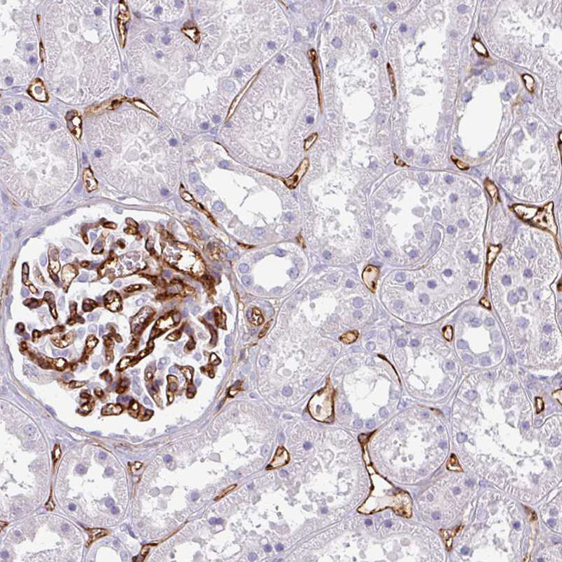 Immunohistochemical staining of human kidney shows moderate to strong membranous positivity in endothelial cells.