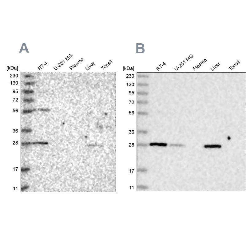 Western blot analysis using Anti-BPHL antibody HPA036753 (A) shows similar pattern to independent antibody HPA036752 (B).
