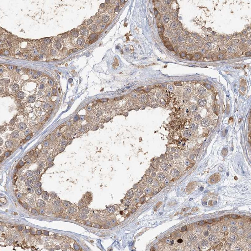 Immunohistochemical staining of human testis shows moderate cytoplasmic positivity in cells in seminiferus ducts.