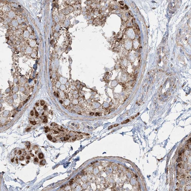 Immunohistochemical staining of human testis shows strong cytoplasmic positivity in Leydig cells and subset of cells in seminiferous ducts.