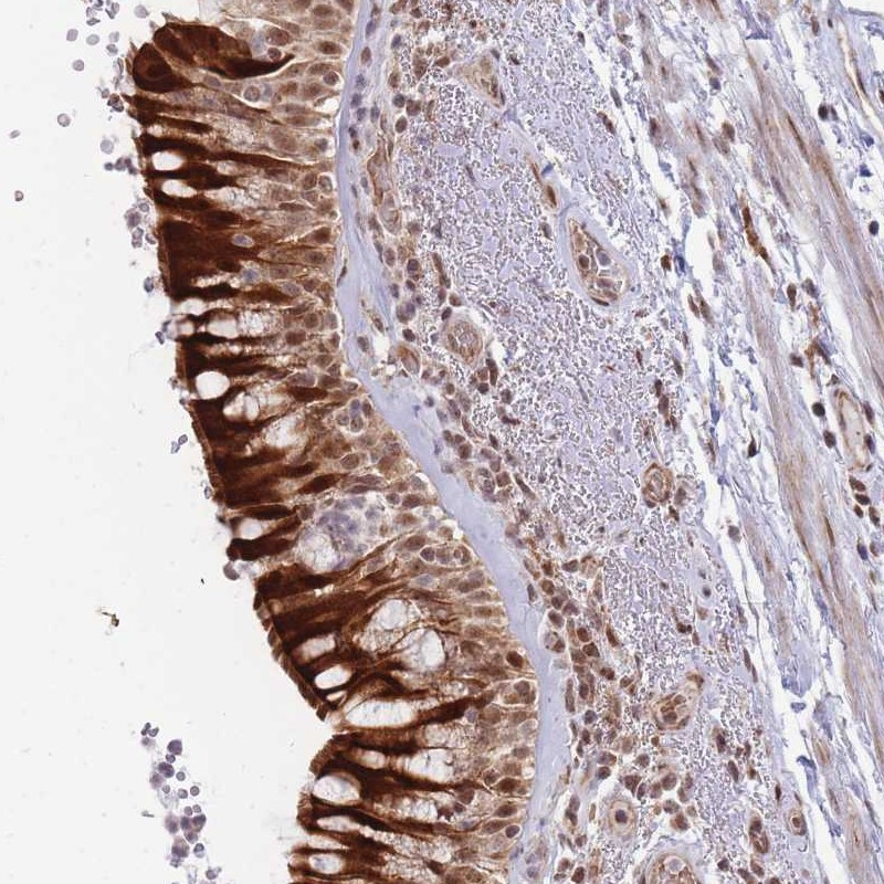 Immunohistochemical staining of human bronchus shows strong cytoplasmic, membranous and nuclear positivity in respiratory epithelial cells.