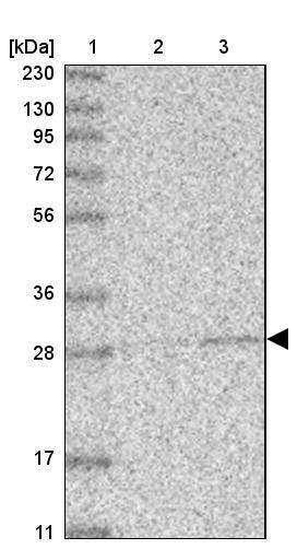 Lane 1: Marker [kDa] 230, 130, 95, 72, 56, 36, 28, 17, 11<br/>Lane 2: Human cell line RT-4<br/>Lane 3: Human cell line U-251MG sp