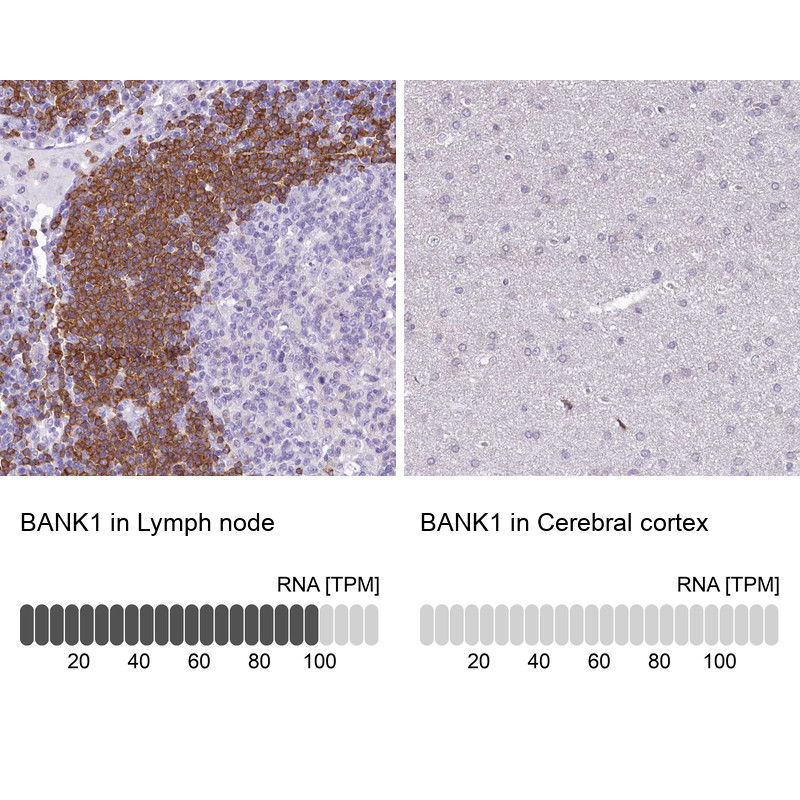 Immunohistochemistry analysis in human lymph node and cerebral cortex tissues using HPA037002 antibody. Corresponding BANK1 RNA-seq data are presented for the same tissues.