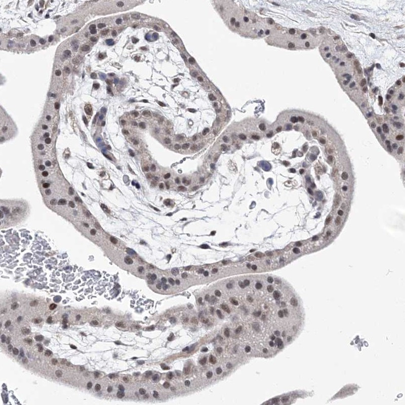 Immunohistochemical staining of human placenta shows moderate nuclear positivity in trophoblastic cells.