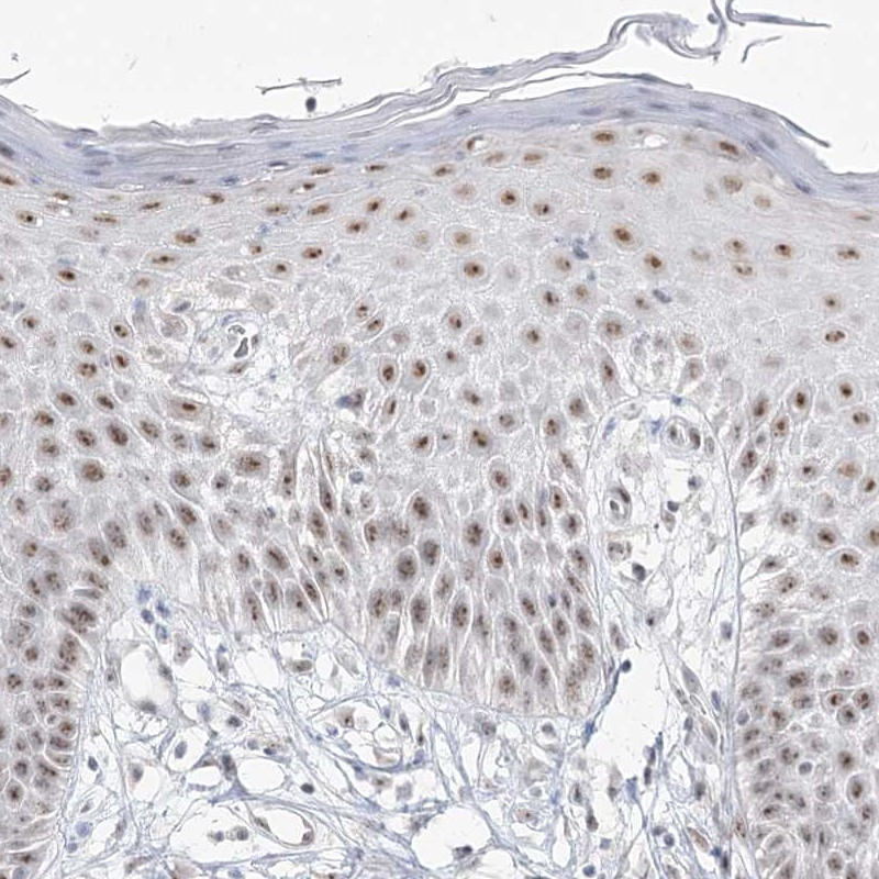 Immunohistochemical staining of human vulva/anal skin shows moderate nucleolar positivity in squamous epithelial cells.