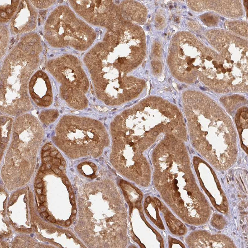 Immunohistochemical staining of human kidney shows strong cytoplasmic and membranous positivity in cells in tubules.