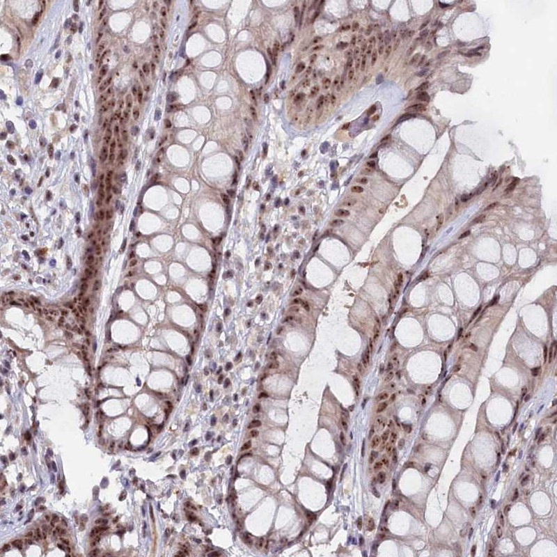 Immunohistochemical staining of human rectum shows moderate nucleolar positivity in glandular cells.