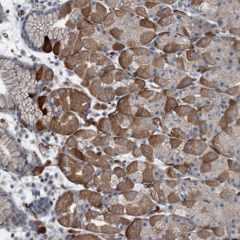 Immunohistochemical staining of human stomach, lower shows strong cytoplasmic positivity in glandular cells.