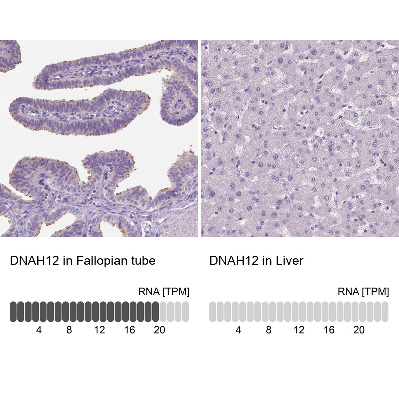 Immunohistochemistry analysis in human fallopian tube and liver tissues using HPA037493 antibody. Corresponding DNAH12 RNA-seq data are presented for the same tissues.
