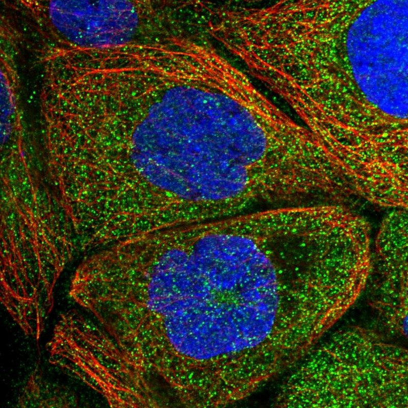 Immunofluorescent staining of human cell line A-431 shows localization to cytosol.