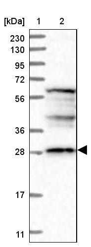 Lane 1: Marker [kDa] 230, 130, 95, 72, 56, 36, 28, 17, 11<br/>Lane 2: Human cell line RT-4