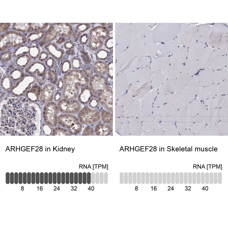 Immunohistochemistry analysis in human kidney and skeletal muscle tissues using Anti-ARHGEF28 antibody. Corresponding ARHGEF28 RNA-seq data are presented for the same tissues.