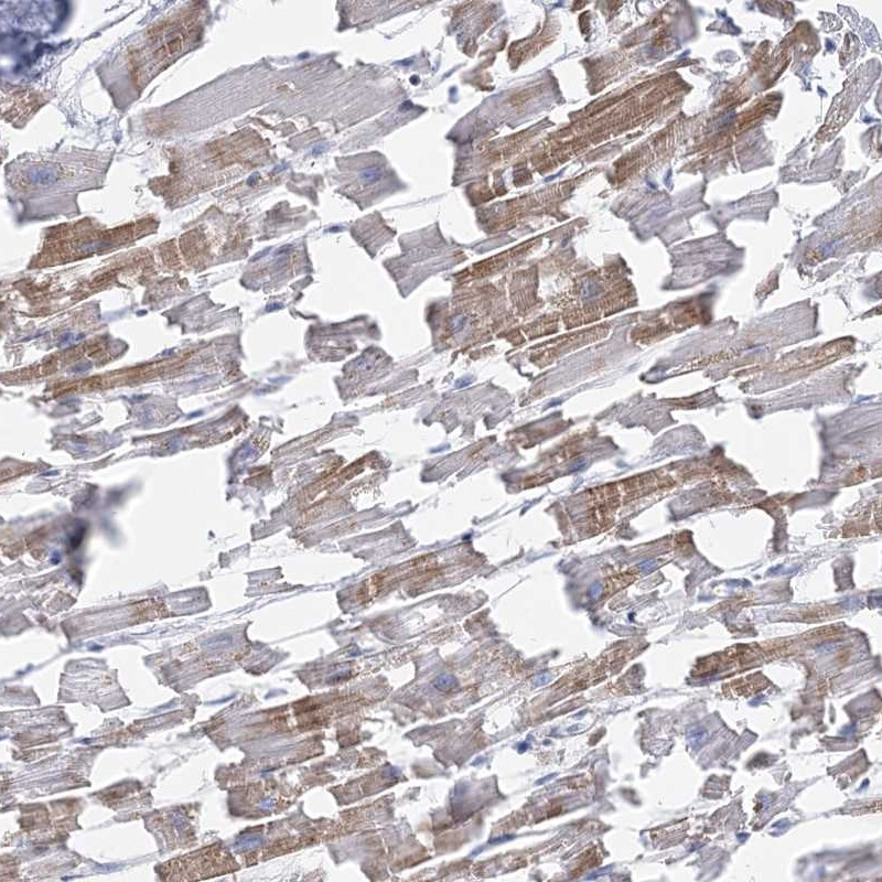 Immunohistochemical staining of human heart muscle shows moderate cytoplasmic positivity in myocytes.
