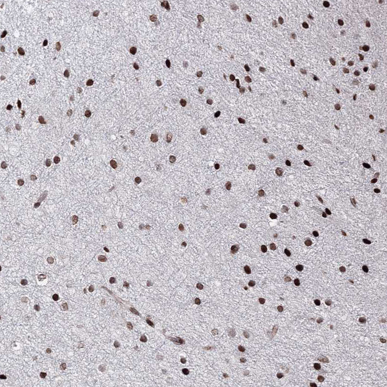 Immunohistochemical staining of human cerebral cortex shows strong nuclear positivity in neurons.