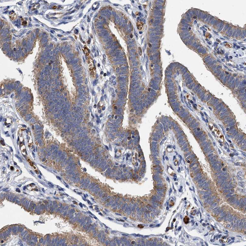 Immunohistochemical staining of human Fallopian tube shows moderate positivity in cytoplasm in glandular cells.