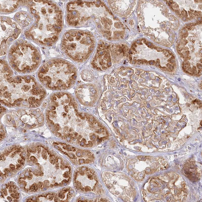 Immunohistochemical staining of human kidney shows strong cytoplasmic positivity in cells in tubules.