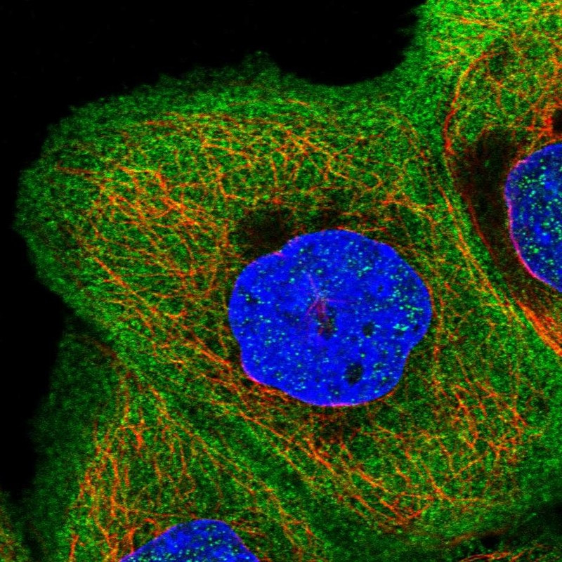 Immunofluorescent staining of human cell line A-431 shows localization to plasma membrane & cytosol.
