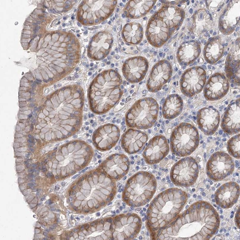 Immunohistochemical staining of human stomach shows moderate cytoplasmic positivity in glandular cells.