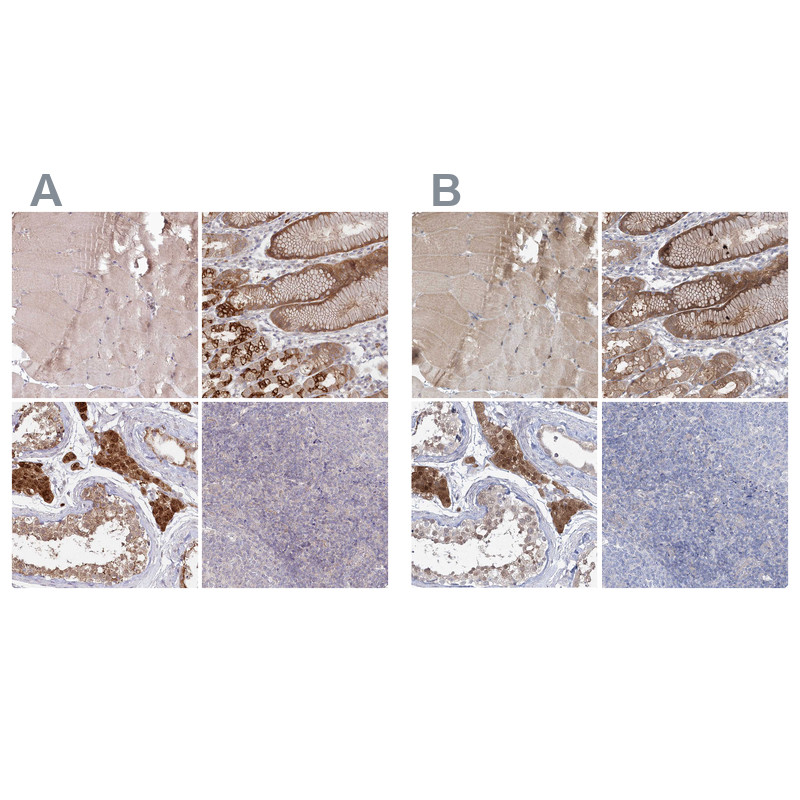 Immunohistochemical staining of human skeletal muscle, stomach, testis and tonsil using Anti-AAMDC antibody HPA037918 (A) shows similar protein distribution across tissues to independent antibody HPA037919 (B).