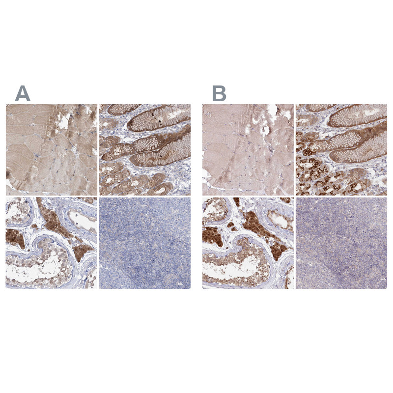 Immunohistochemical staining of human skeletal muscle, stomach, testis and tonsil using Anti-AAMDC antibody HPA037919 (A) shows similar protein distribution across tissues to independent antibody HPA037918 (B).