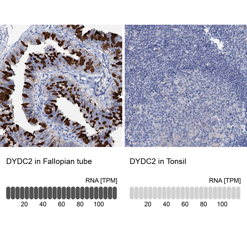 Immunohistochemistry analysis in human fallopian tube and tonsil tissues using Anti-DYDC2 antibody. Corresponding DYDC2 RNA-seq data are presented for the same tissues.