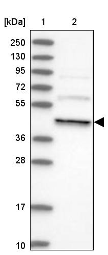 Lane 1: Marker [kDa] 250, 130, 95, 72, 55, 36, 28, 17, 10<br/>Lane 2: Human cell line RT-4