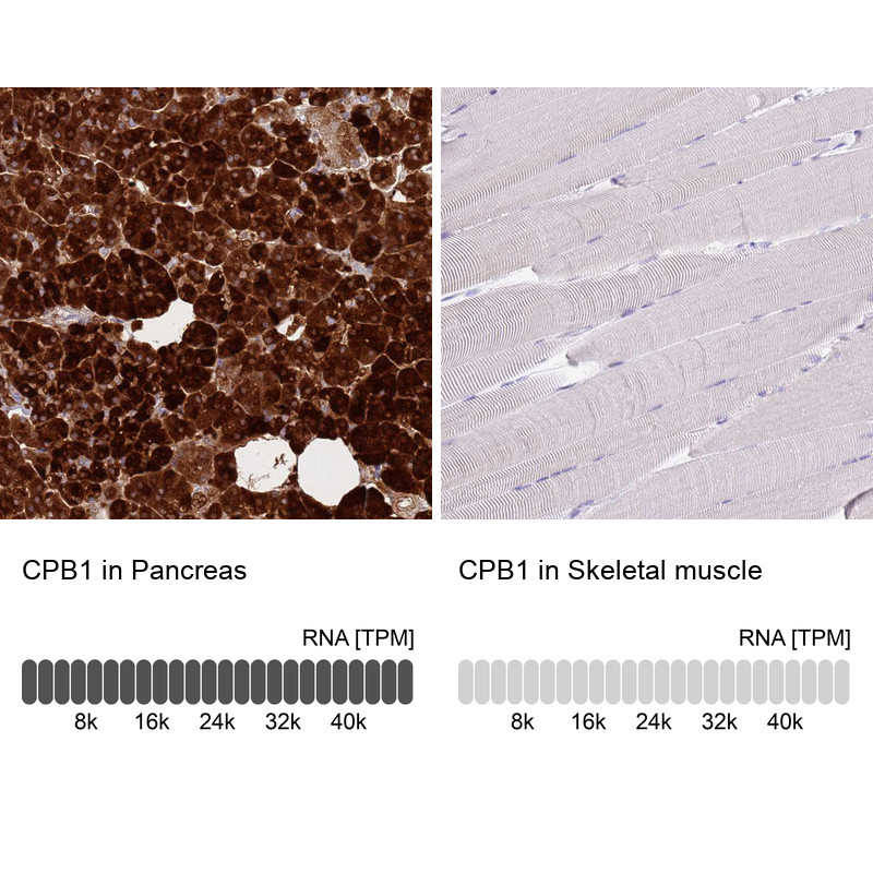 Immunohistochemistry analysis in human pancreas and skeletal muscle tissues using HPA038069 antibody. Corresponding CPB1 RNA-seq data are presented for the same tissues.