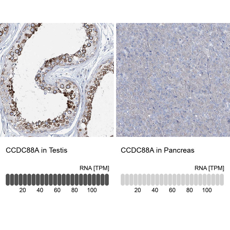 Immunohistochemistry analysis in human testis and pancreas tissues using Anti-CCDC88A antibody. Corresponding CCDC88A RNA-seq data are presented for the same tissues.