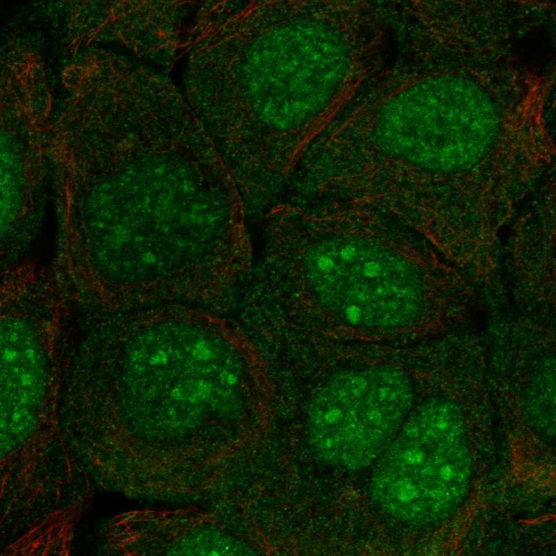 Immunofluorescent staining of human cell line HaCaT shows localization to nucleoplasm & nucleoli.