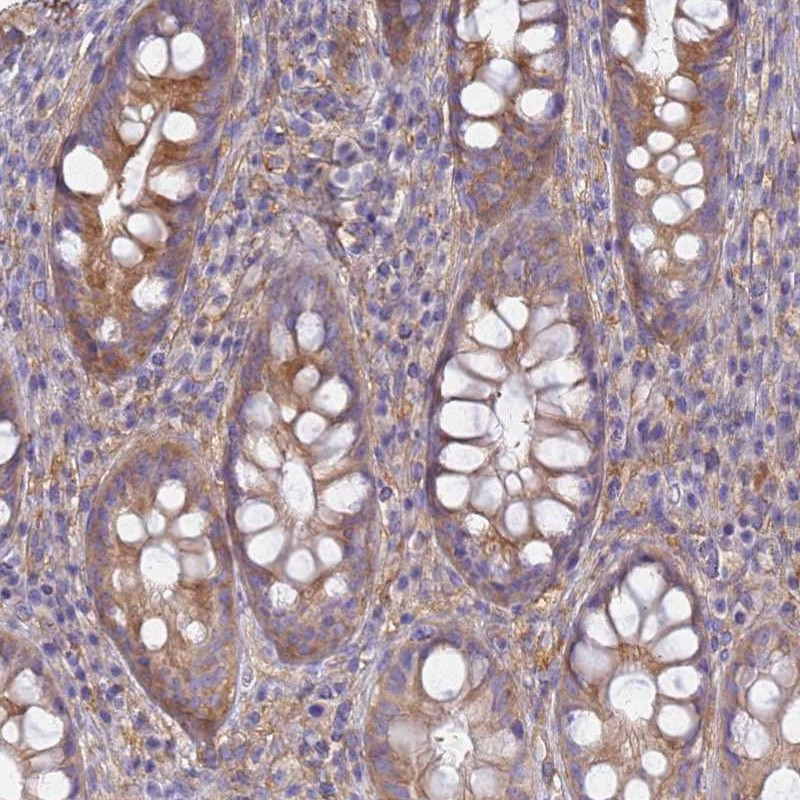 Immunohistochemical staining of human rectum shows moderate cytoplasmic positivity in glandular cells.