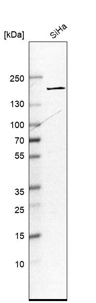 Western blot analysis in human cell line SiHa.