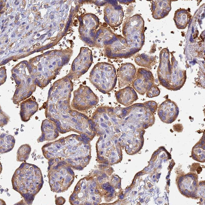 Immunohistochemical staining of human placenta shows strong cytoplasmic positivity in trophoblastic cells.