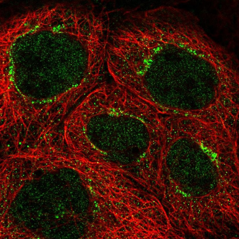 Immunofluorescent staining of human cell line A-431 shows positivity in nucleus & the Golgi apparatus.