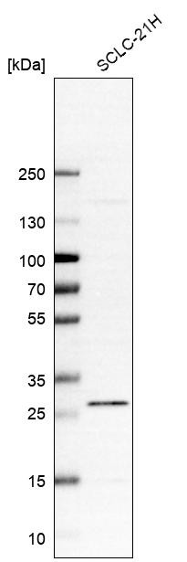 Western blot analysis in human cell line SCLC-21H.