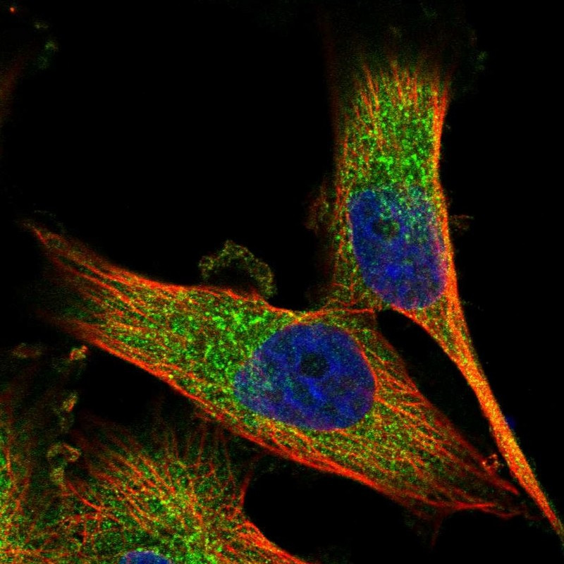 Immunofluorescent staining of human cell line U-251 MG shows localization to cytosol.