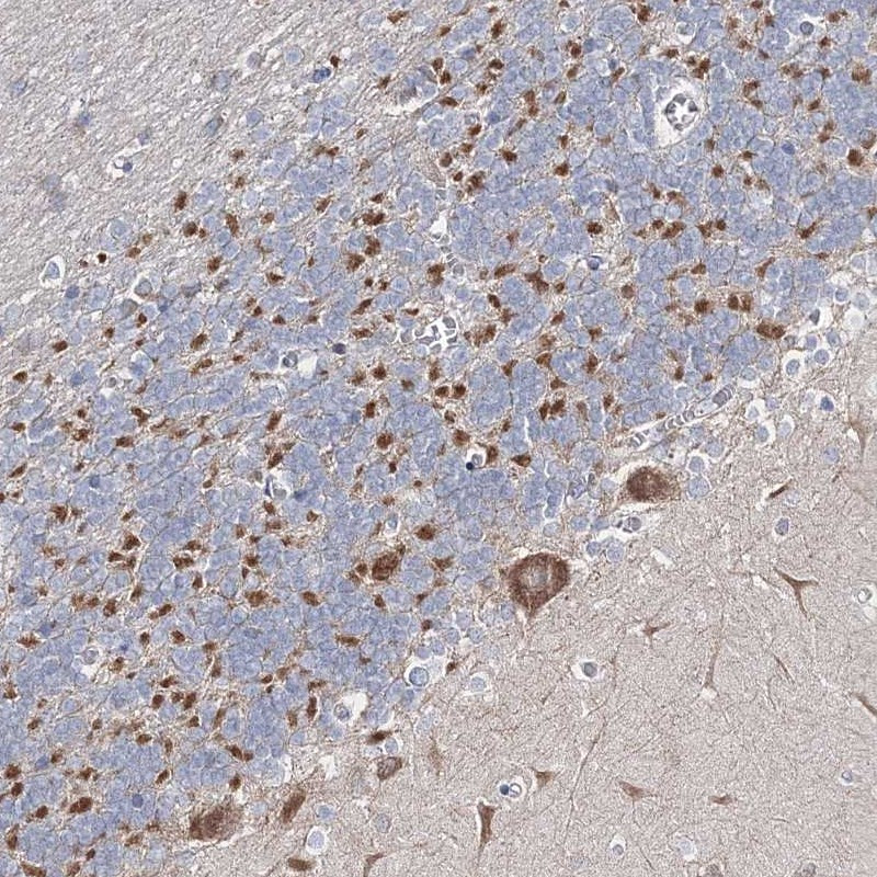 Immunohistochemical staining of human cerebellum shows cytoplasmic positivity in purkinje cells along with neuronal processes.
