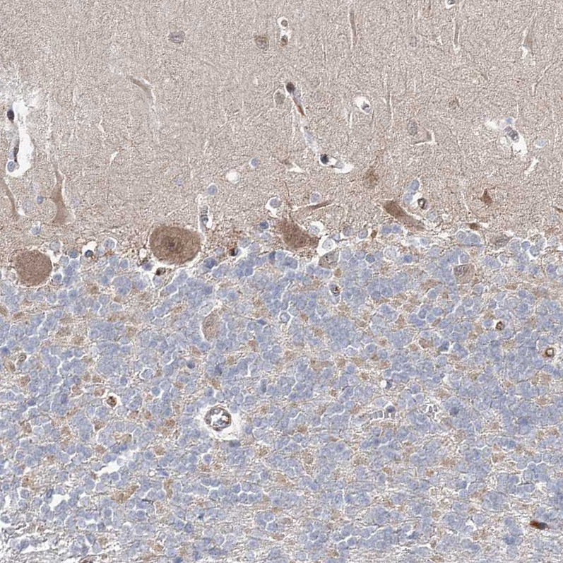 Immunohistochemical staining of human cerebellum shows moderate positivity in Purkinje cells.