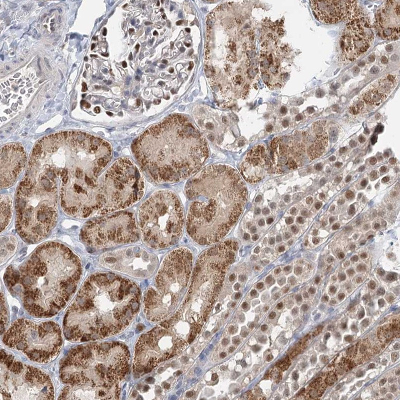 Immunohistochemical staining of human kidney shows strong cytoplasmic and nuclear positivity in cells in tubules.
