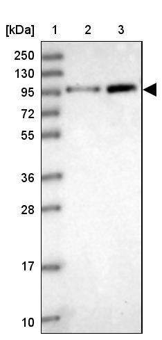 Lane 1: Marker [kDa] 250, 130, 95, 72, 55, 36, 28, 17, 10<br/>Lane 2: Human cell line RT-4<br/>Lane 3: Human cell line U-251MG sp