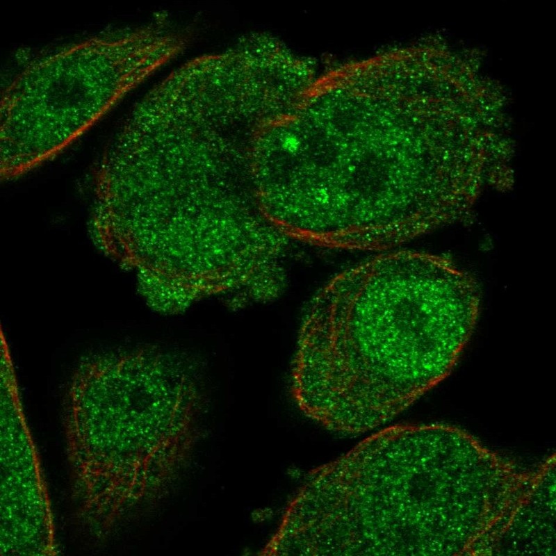 Immunofluorescent staining of human cell line PC-3 shows localization to nucleoplasm & cytosol.