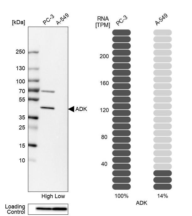 Western blot analysis in human cell lines PC-3 and A-549 using Anti-ADK antibody. Corresponding ADK RNA-seq data are presented for the same cell lines. Loading control: Anti-PPIB.