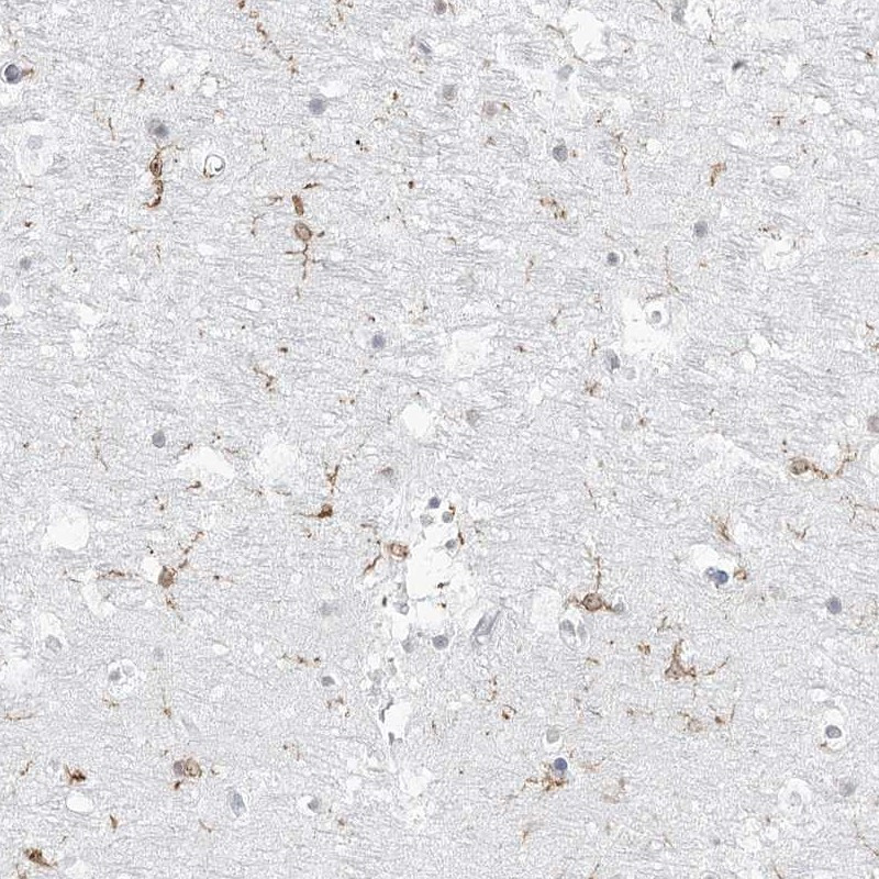 Immunohistochemical staining of human hippocampus shows distinct positivity in microglia.
