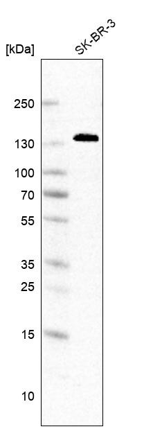 Western blot analysis in human cell line SK-BR-3.