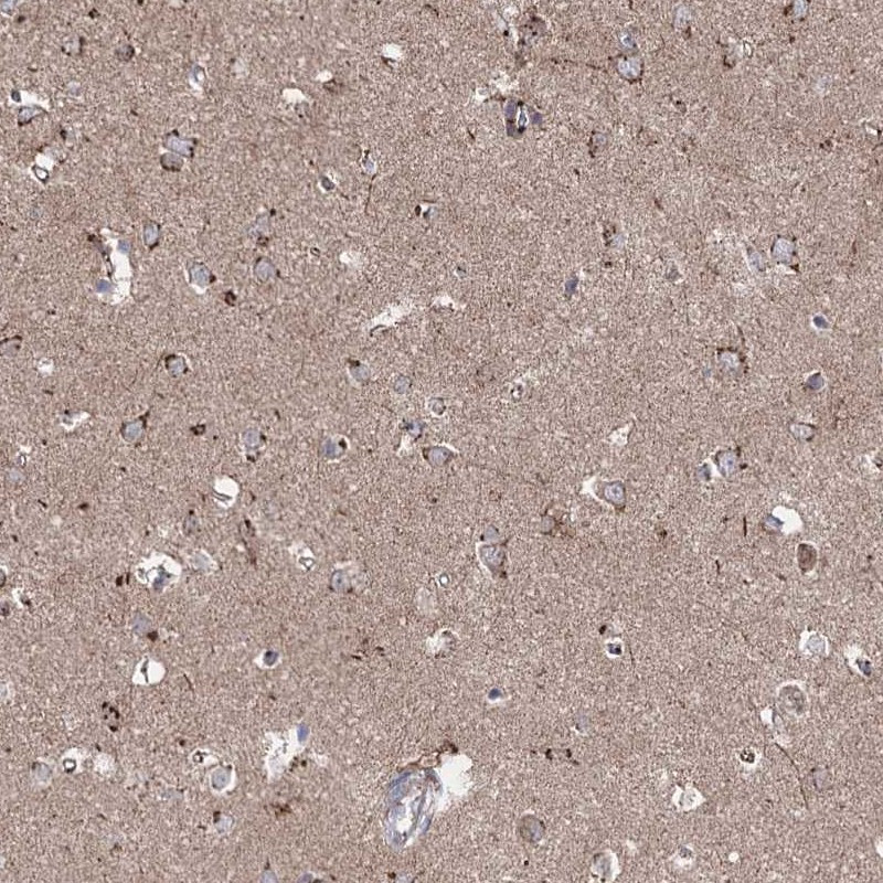 Immunohistochemical staining of human cerebral cortex shows granular cytoplasmic positivity in neuronal cells.