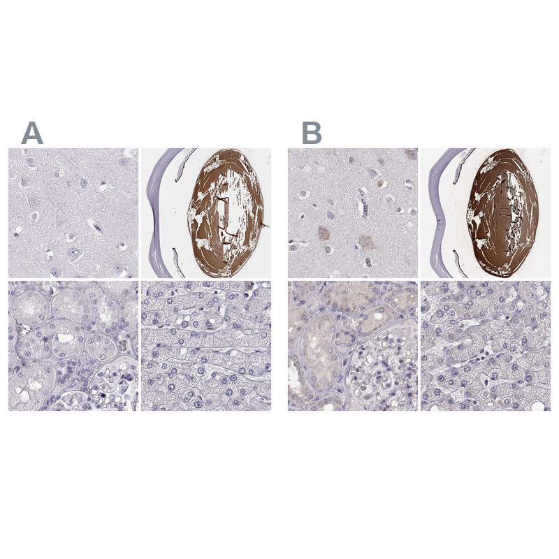 Immunohistochemical staining of human cerebral cortex, eye, kidney and liver using Anti-BFSP2 antibody HPA038464 (A) shows similar protein distribution across tissues to independent antibody HPA062959 (B).