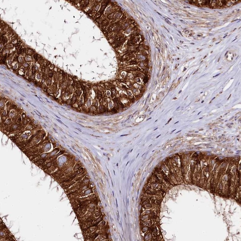 Immunohistochemical staining of human epididymis shows cytoplasmic positivity in glandular cells.