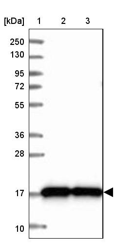 Lane 1: Marker [kDa] 250, 130, 95, 72, 55, 36, 28, 17, 10<br/>Lane 2: Human cell line RT-4<br/>Lane 3: Human cell line U-251MG sp